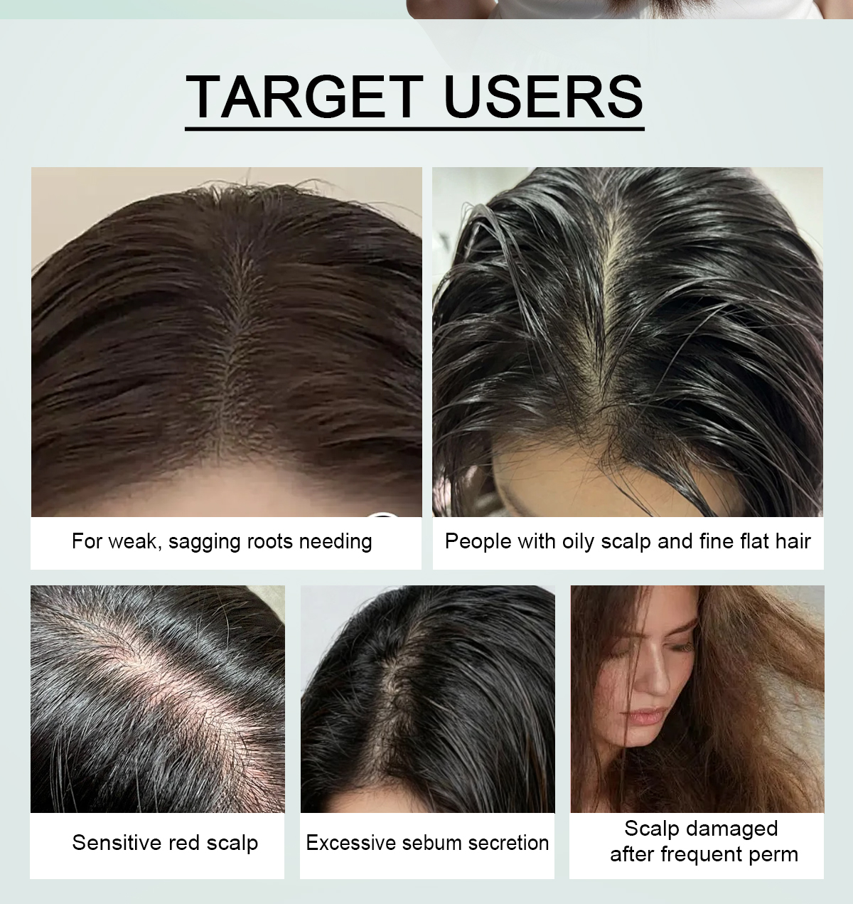 Image [5]-Oil Control Fluffy Shampoo Lifts Roots and Eliminates Greasy Flat Hair