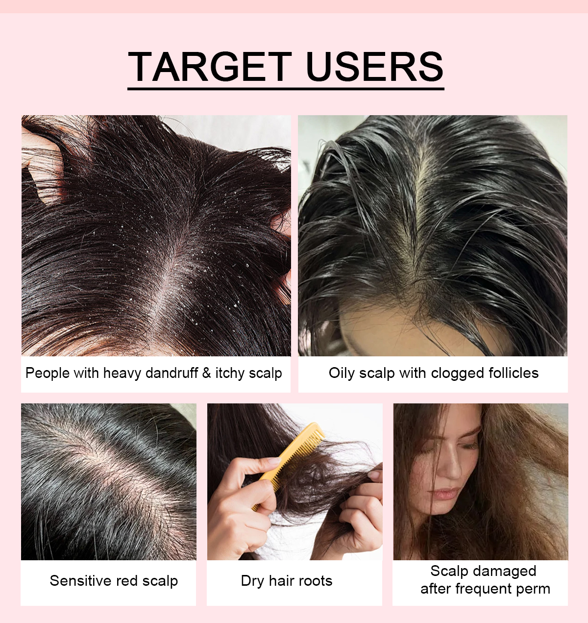 Image [5]-Clarifying Anti Dandruff Shampoo Soothes Itchy Scalp and Balances Sebum